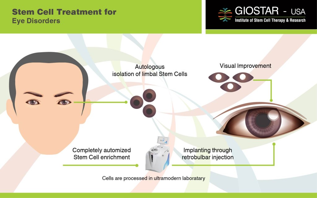 Stem Cell Treatment for Eye Disorders