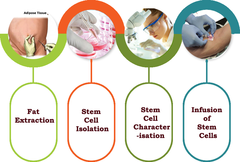 Stem Cell Therapy Process